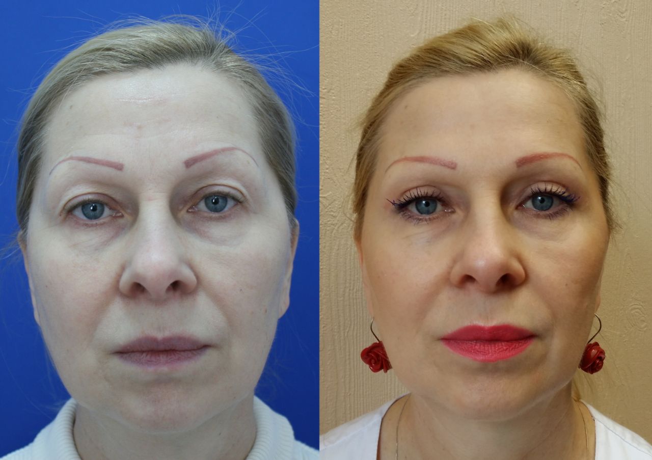 канал пластический хирург. доктор левин пластический хирург. доктор пластик москва. клиника пластики москва. медицинская школа пластическая хирургия.