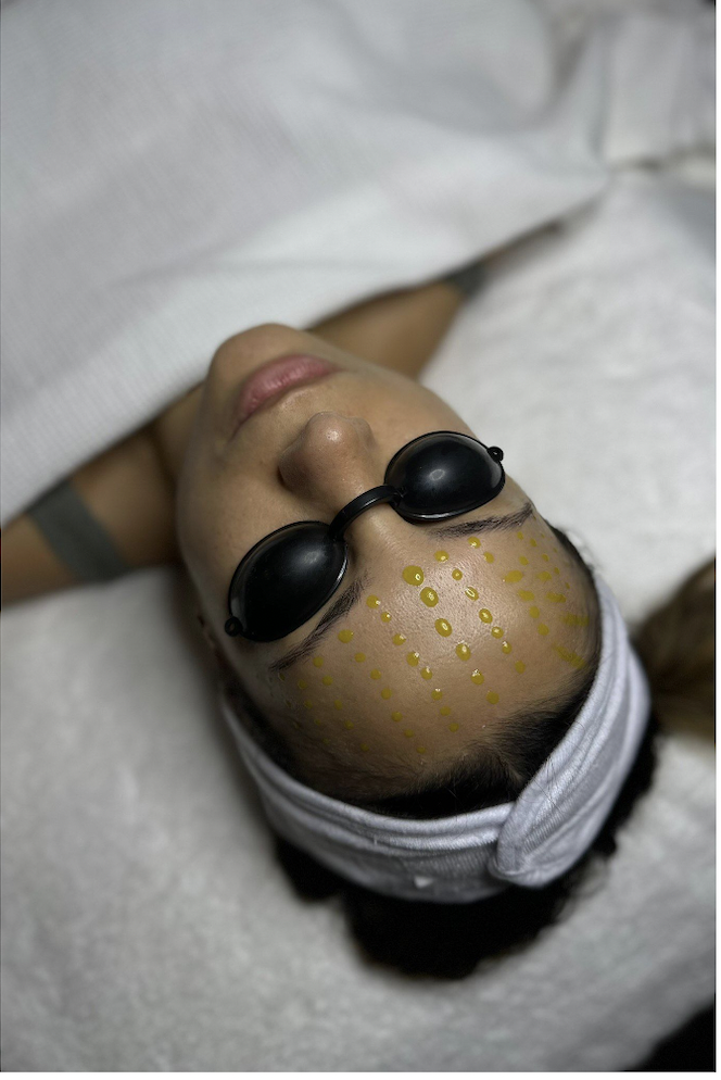 BioRePeel treatment at Beauty Studio by Hanna in Mount Pleasant, SC