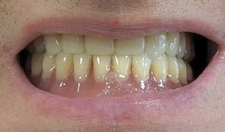 Пациент после лечения: кейс 2