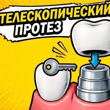 Протез на телескопических коронках