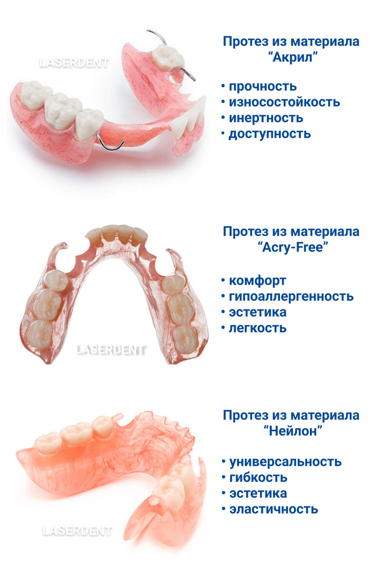Какие бывают зубные протезы: фото, описания, преимущества