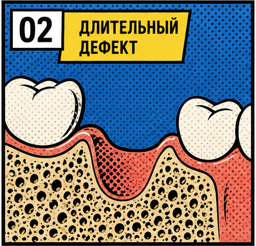 Длительное отсутствие зуба