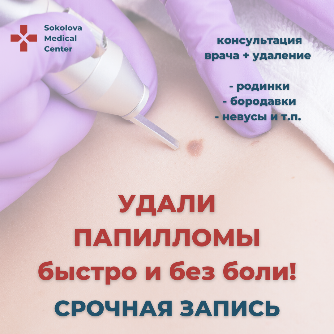 После Удаления Папиллом Можно Заниматься Сексом