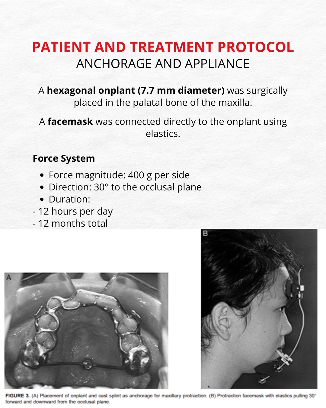 Stage showing further skeletal advancement of the maxilla — photo 6 of 10