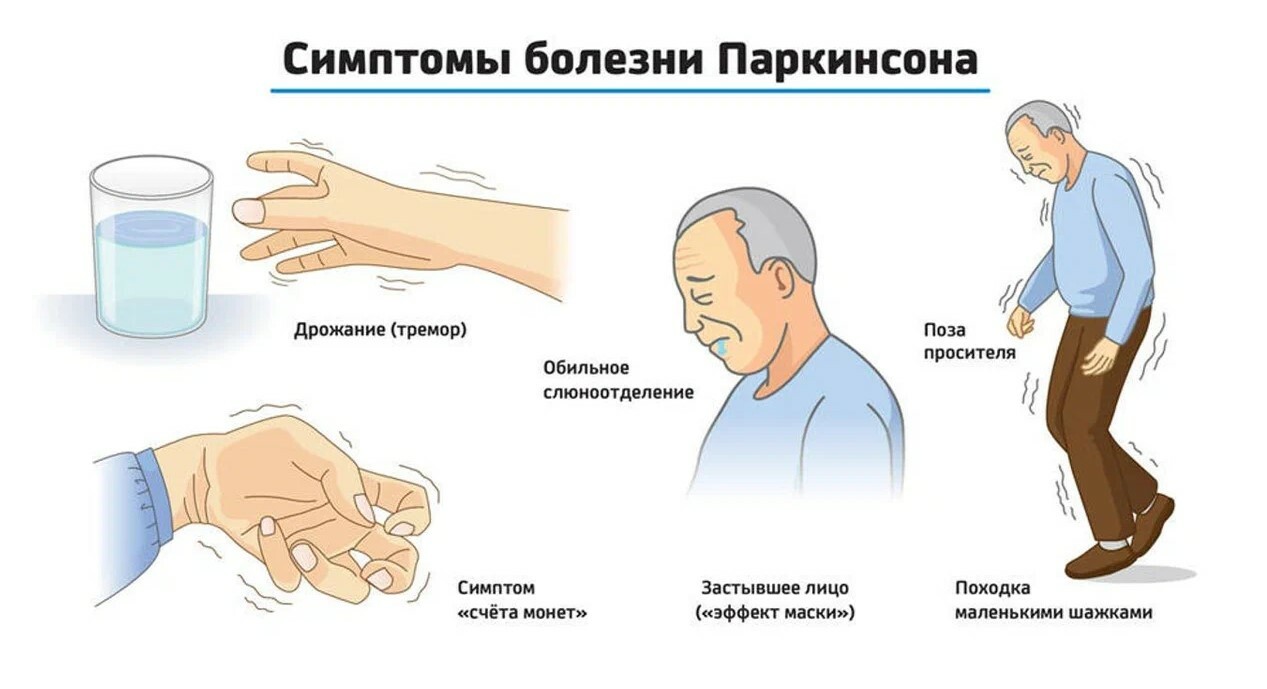 Болезнь Паркинсона в неврологии: этиология заболевания, симптомы, диагностика болезни, лечение