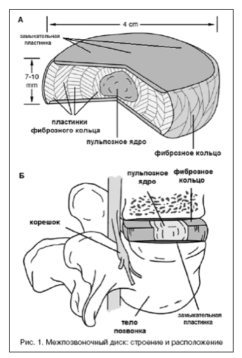 МРТ картина дегенеративно-дистрофических изменений шейного отдела позвоночника