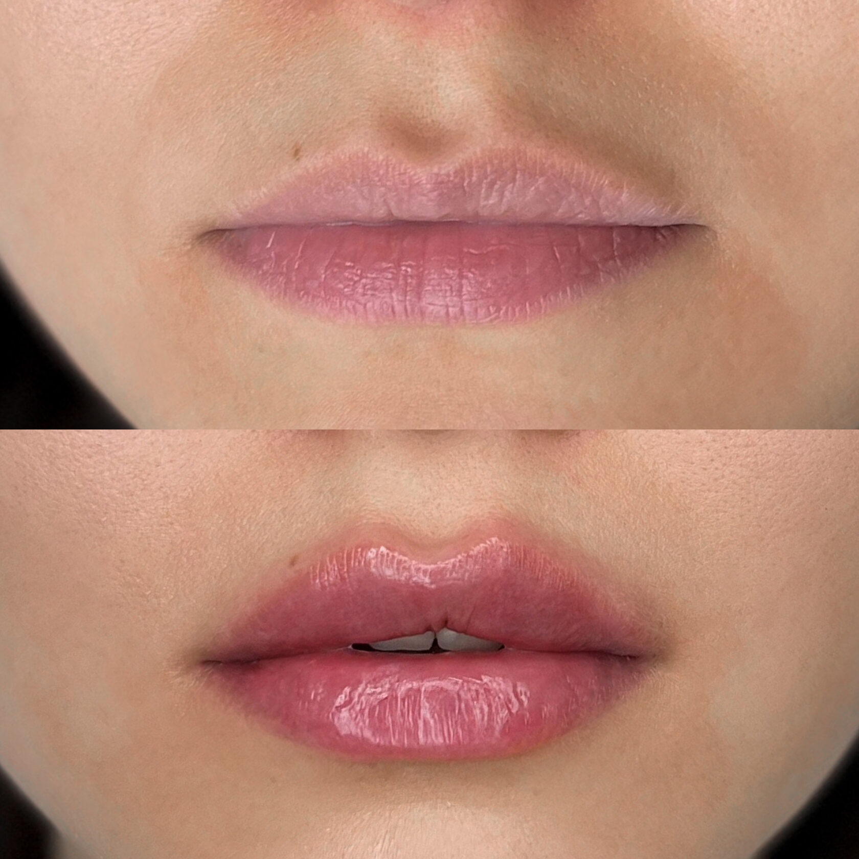 Материал из портфолио Inlove Beauty