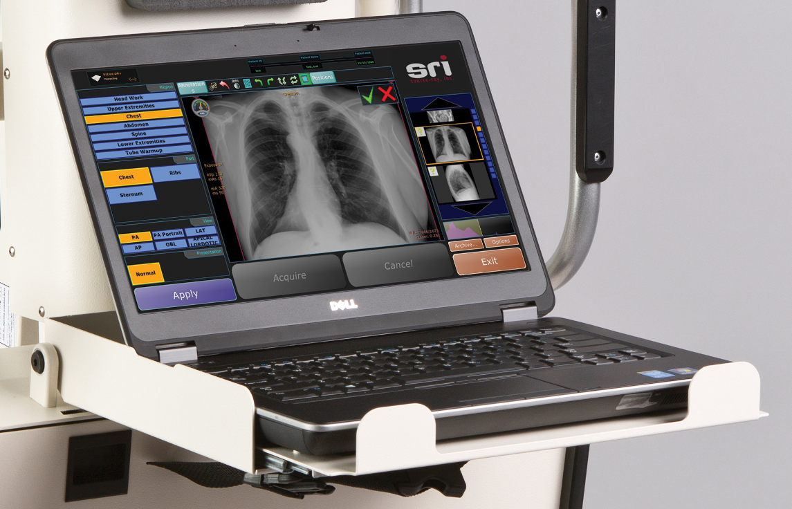 D a xray monolith. Siger Digital x-ray Imaging System. Diagnostic x-ray System EPX-f2800. Portable x-ray. X ray d-205bs.