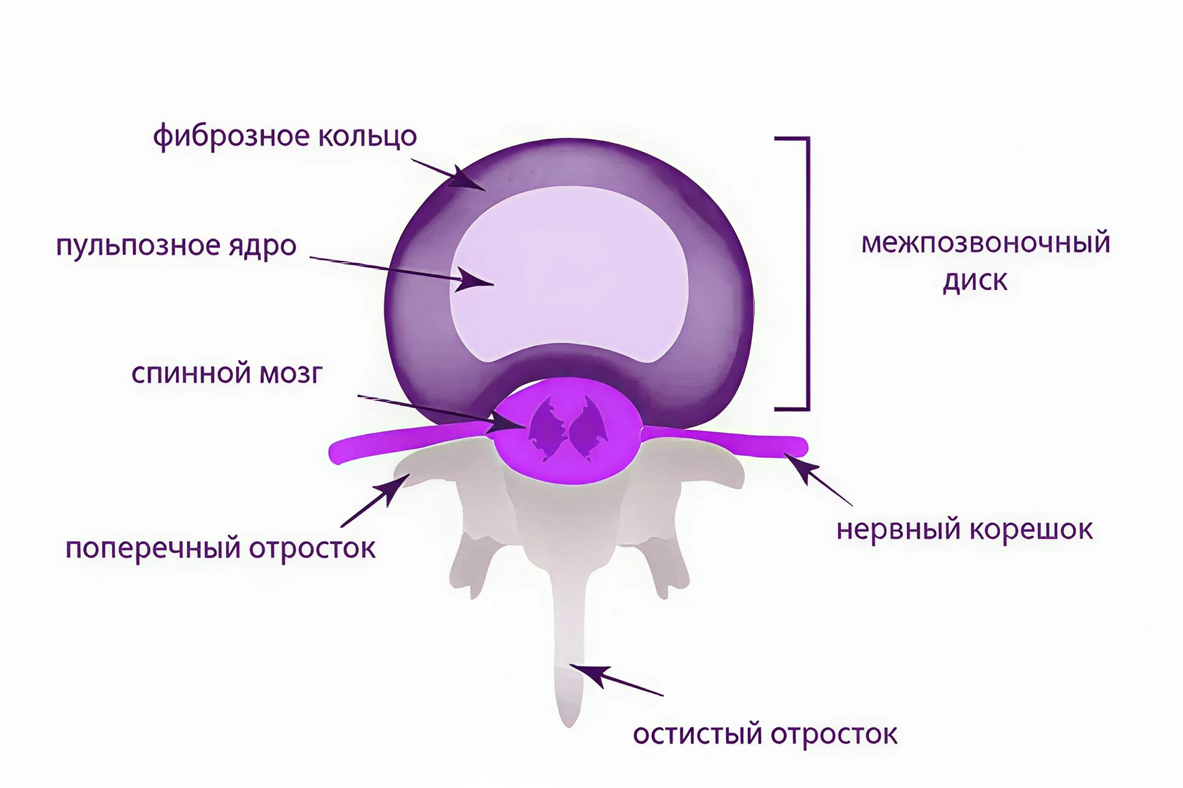 Строение межпозвонкового диска: фиброзное кольцо, пульпозное ядро, спинной мозг, нервный корешок
