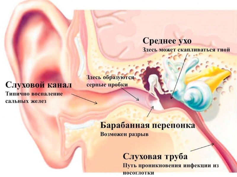 Болеутоляющие ушные капли