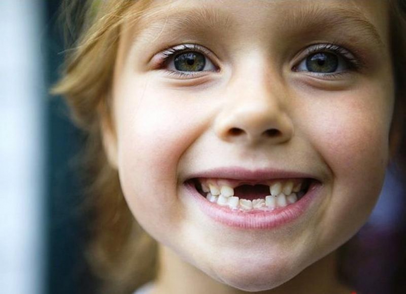 Смена молочных зубов постоянными: оптимальный возраст