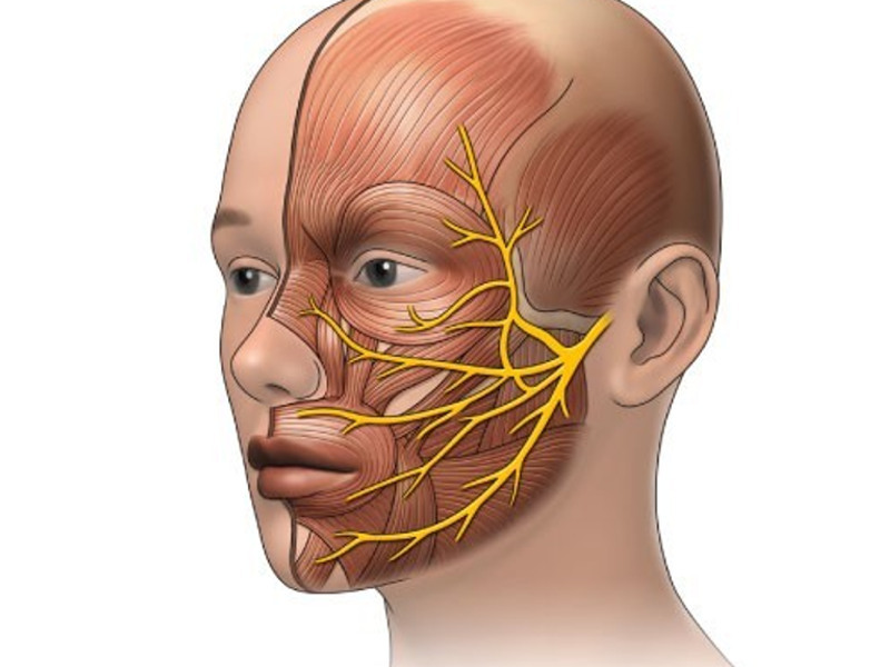 Поражения лицевого нерва в неврологии: особенности, причины, симптомы и лечение