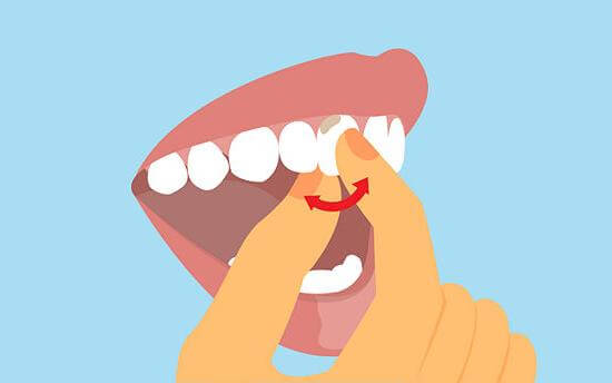 Вывих зуба, зуб шатается: что делать?