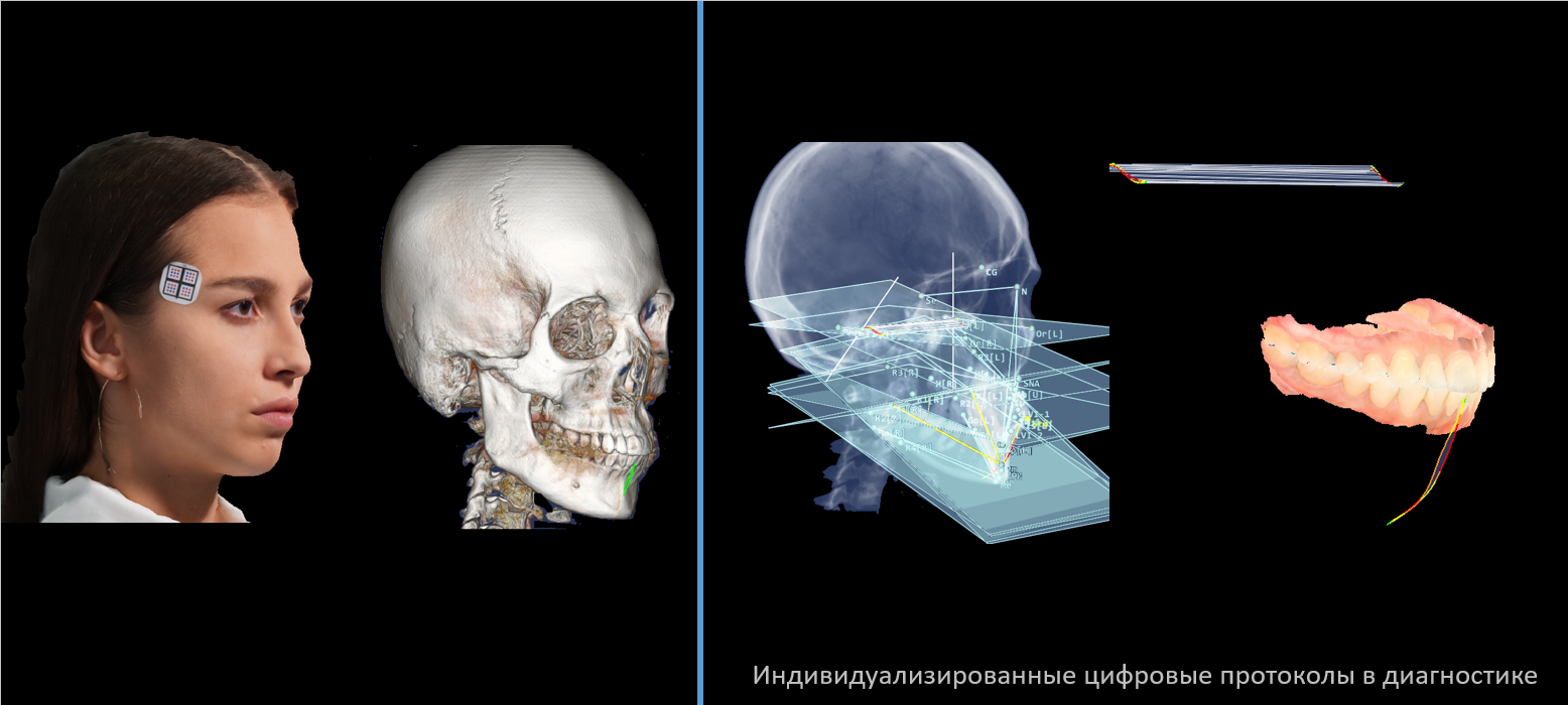 Цикл вебинаров “Гнатология на максималках”