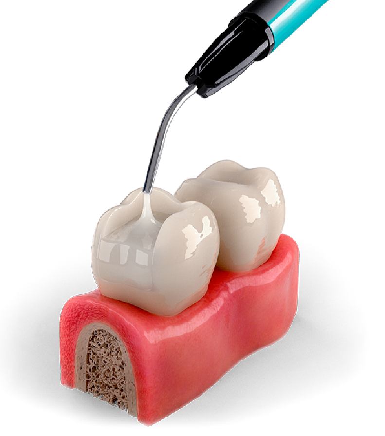 Filling material. Стоматология зубы. Стоматологические материалы. Сайт стоматологии. Зубной материал.