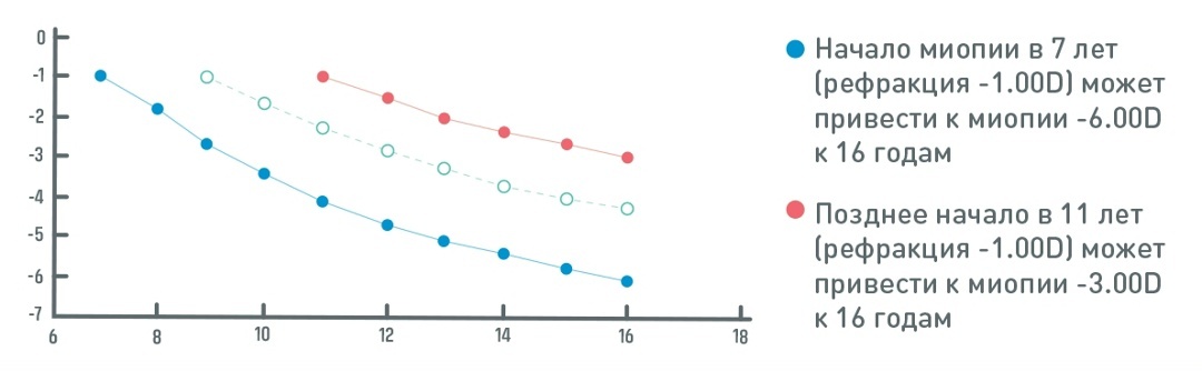 Очки Stellest — главный помощник в контроле миопии у детей, изображение №2