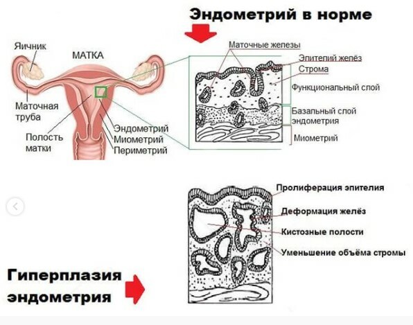 Гистероскопия: причины, симптомы, лечение