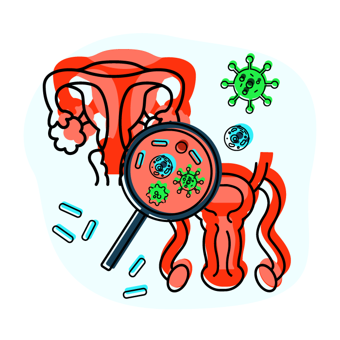 Уреаплазма (Ureaplasma urealyticum, биовар Т-960), определение ДНК