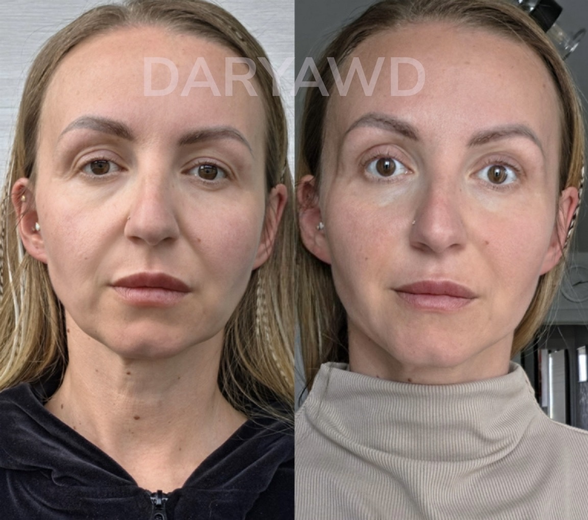 Анна, 39 лет
