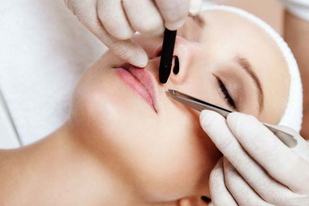 Фотоэпиляция. Электролог это. Электролог это. Электро депиляция. Электролог это.