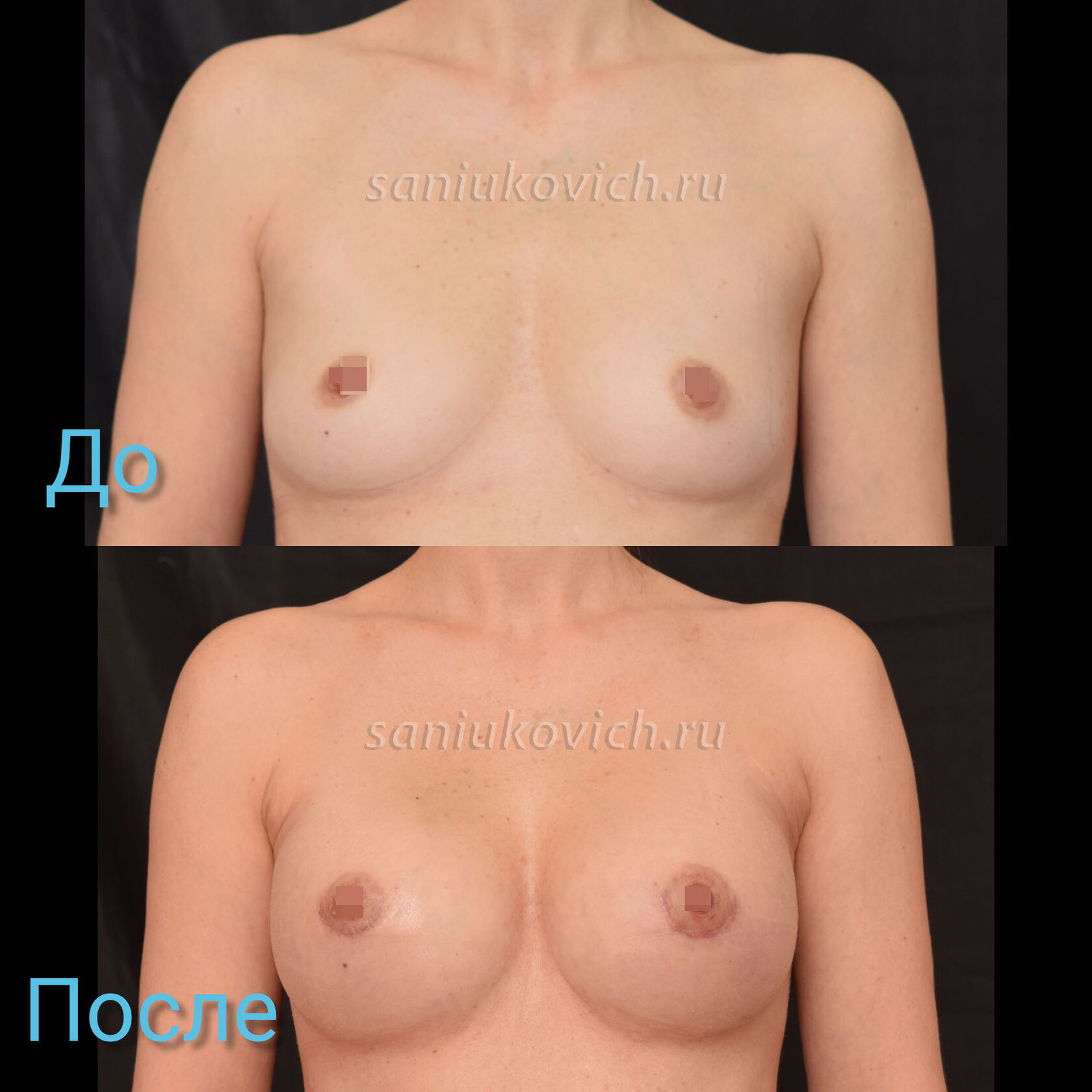 увеличилась одна грудь во время менструации фото 21