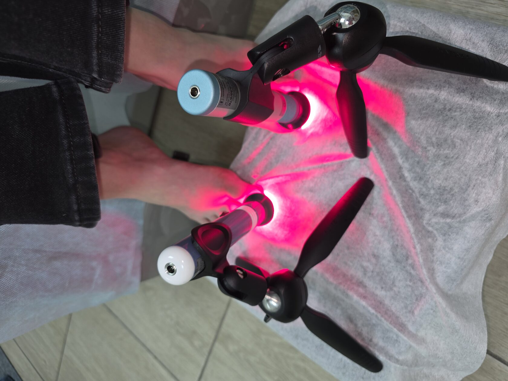 Подолог проводит фотодинамическую терапию