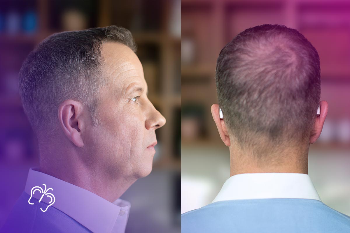 Слуховой аппарат Audeo Lumity