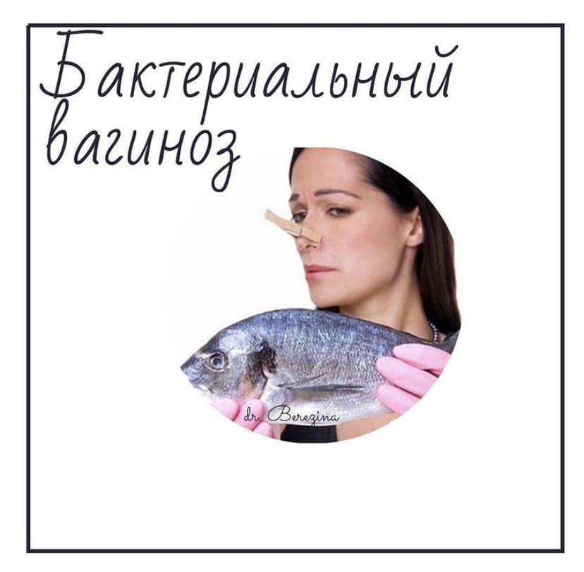 Бактериальный вагиноз