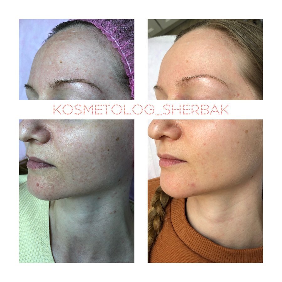 Индивидуальный подбор домашнего ухода в клинике PradusCOSMO, Санкт-Петербург. Косметологический анализ кожи и рекомендация профессиональной косметики