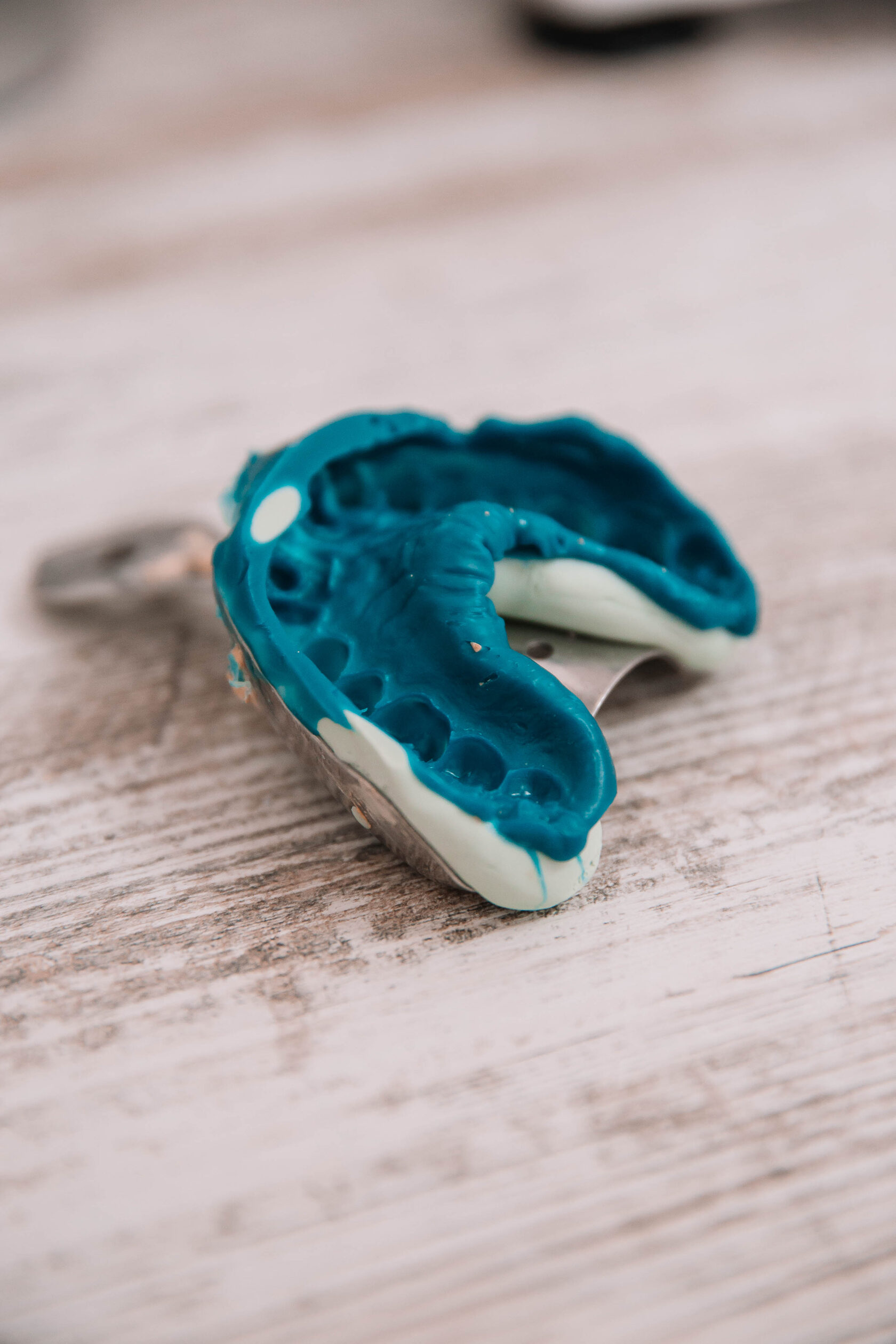 Исправление прикуса