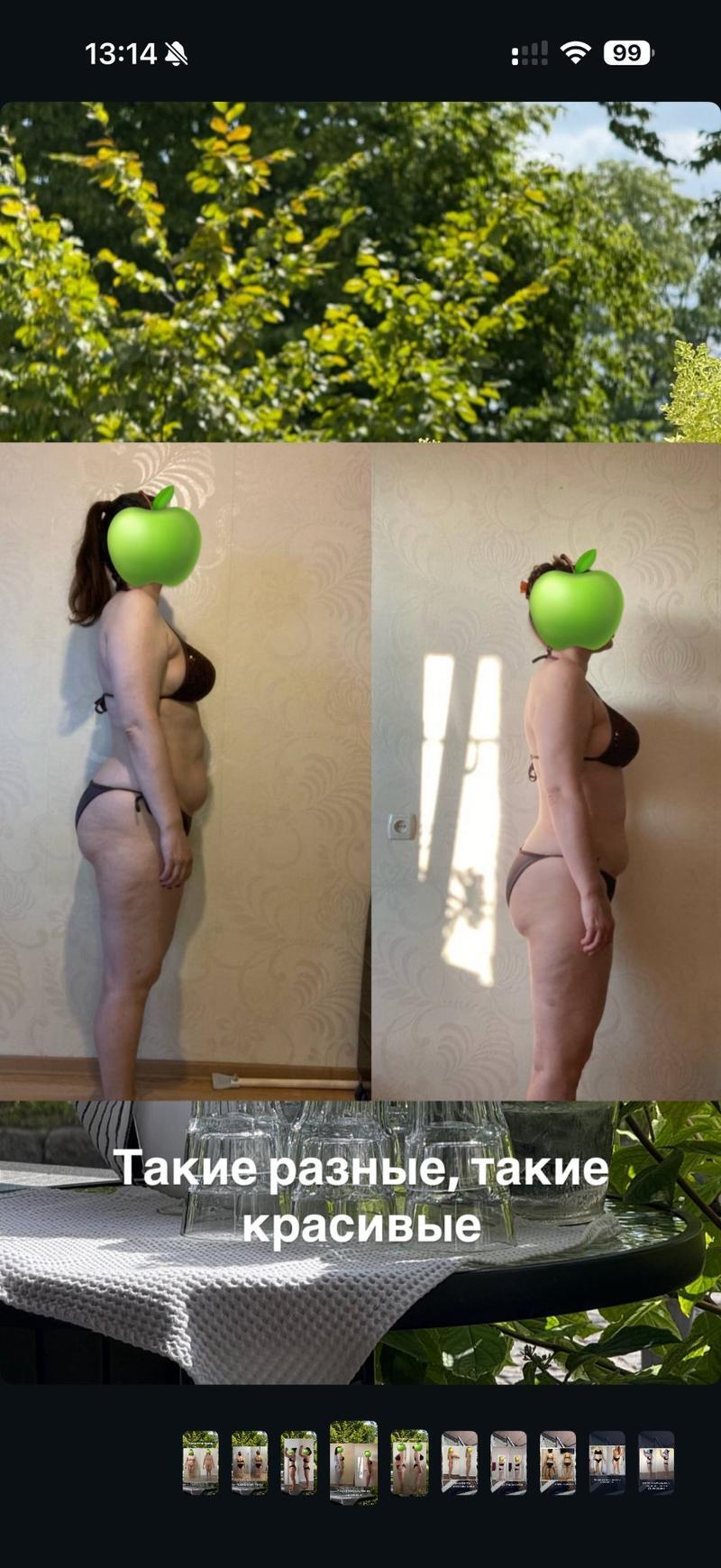 До и после ХМРЗ