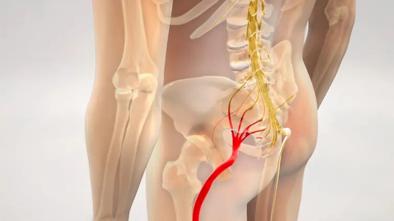 біль у сідниці малюнок