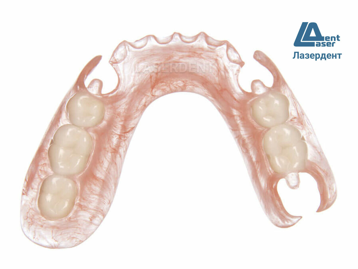 Протез на челюсть без зубов. Частичный съемный протез Flexi n512.