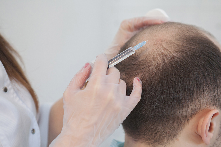 Выпадают волосы процедуры. Мезо волосистой части головы. Плазмолифтинг волосистой части головы. Мезотерапия для волос. Мезотерапия кожи головы.
