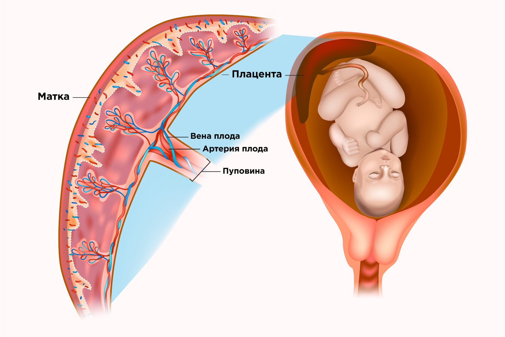 Инфаркт плаценты при беременности — опасно ли это?