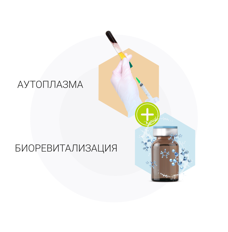 аутоплазма и биоревитализация