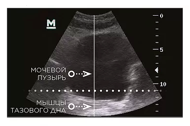 Стул для тренировки мышц тазового дна