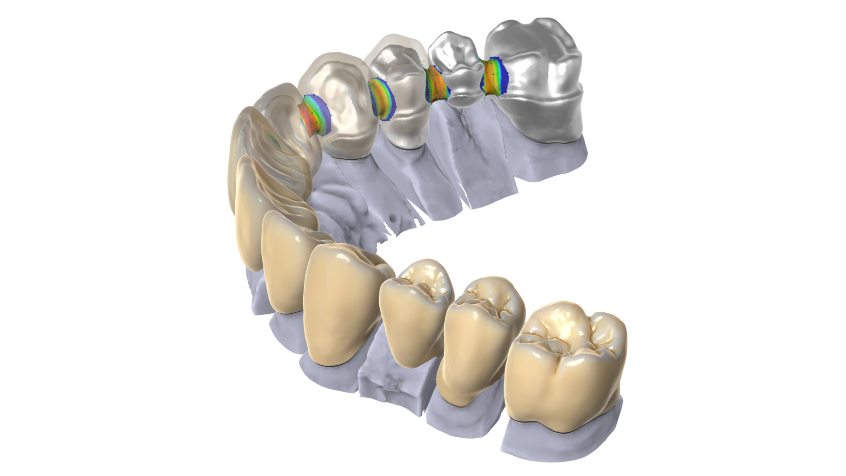 Технология изготовления cerec коронки презентация