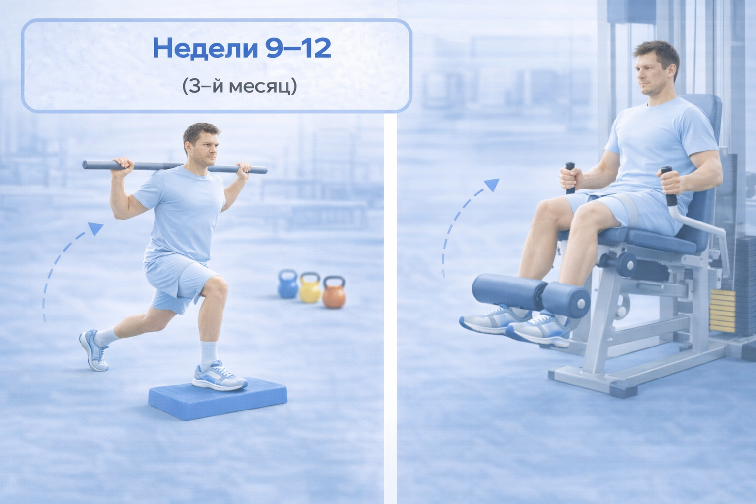 Контроль оси колена при реабилитации после ПКС