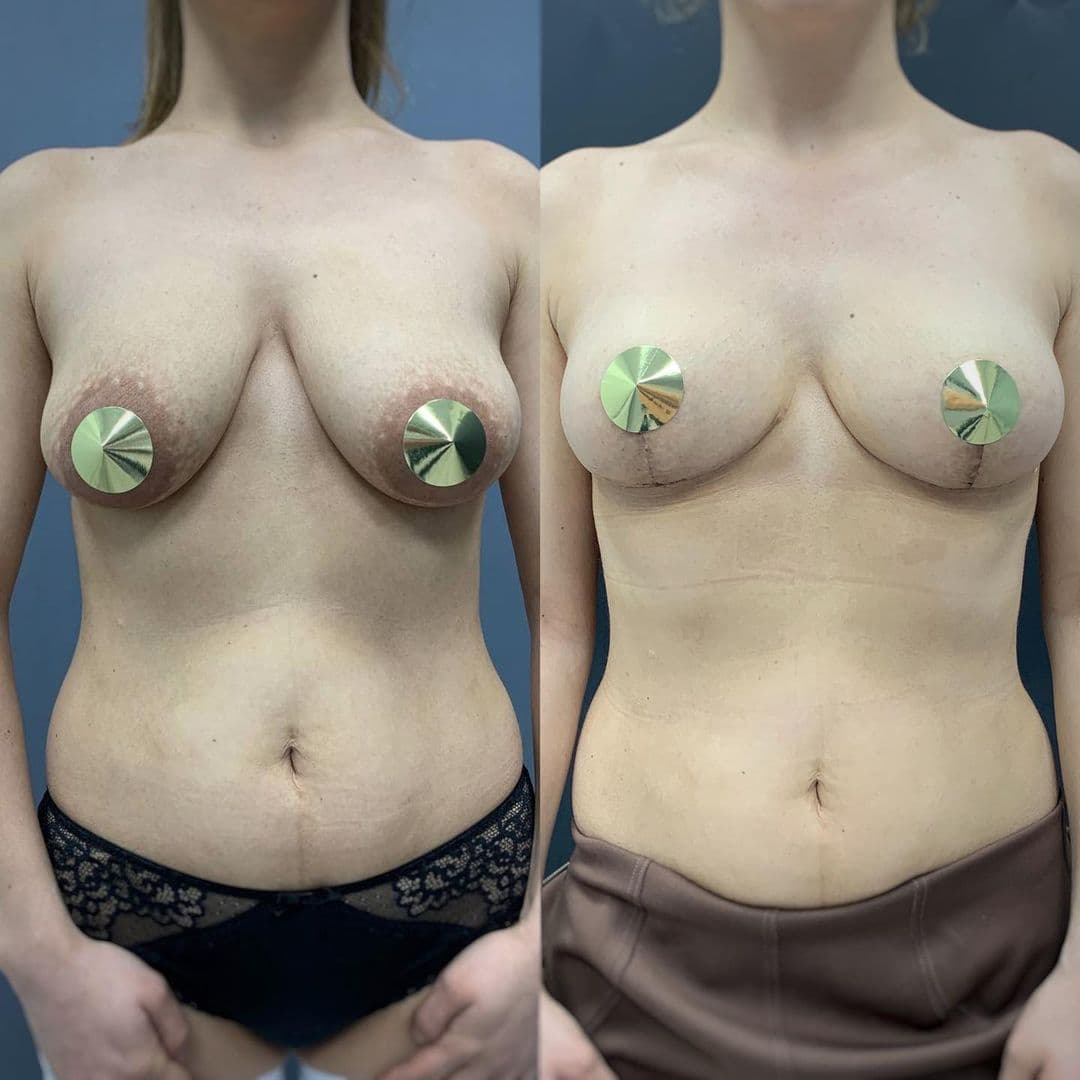 необычная форма груди у женщин фото 49