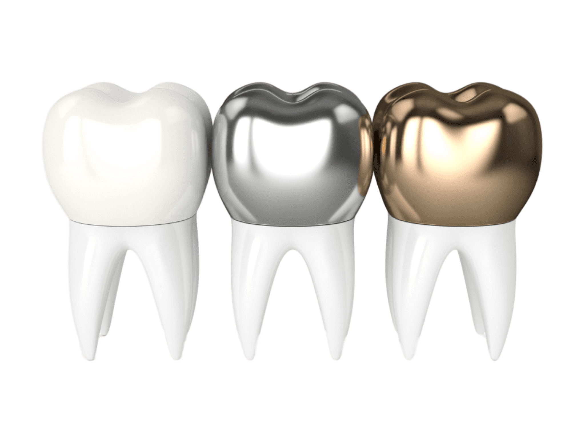 Зубная коронка. Коронка металлокерамика. Металлическая коронка на зуб. Зубные коронки из металлокерамики.