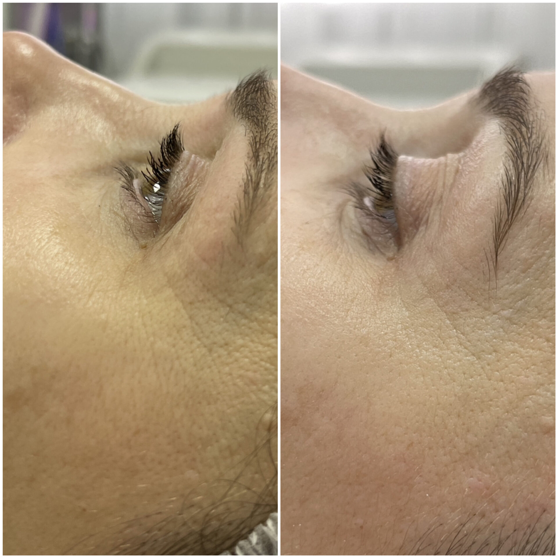 ДО/ПОСЛЕ ЭСТЕТИЧЕСКИХ ПРОЦЕДУР