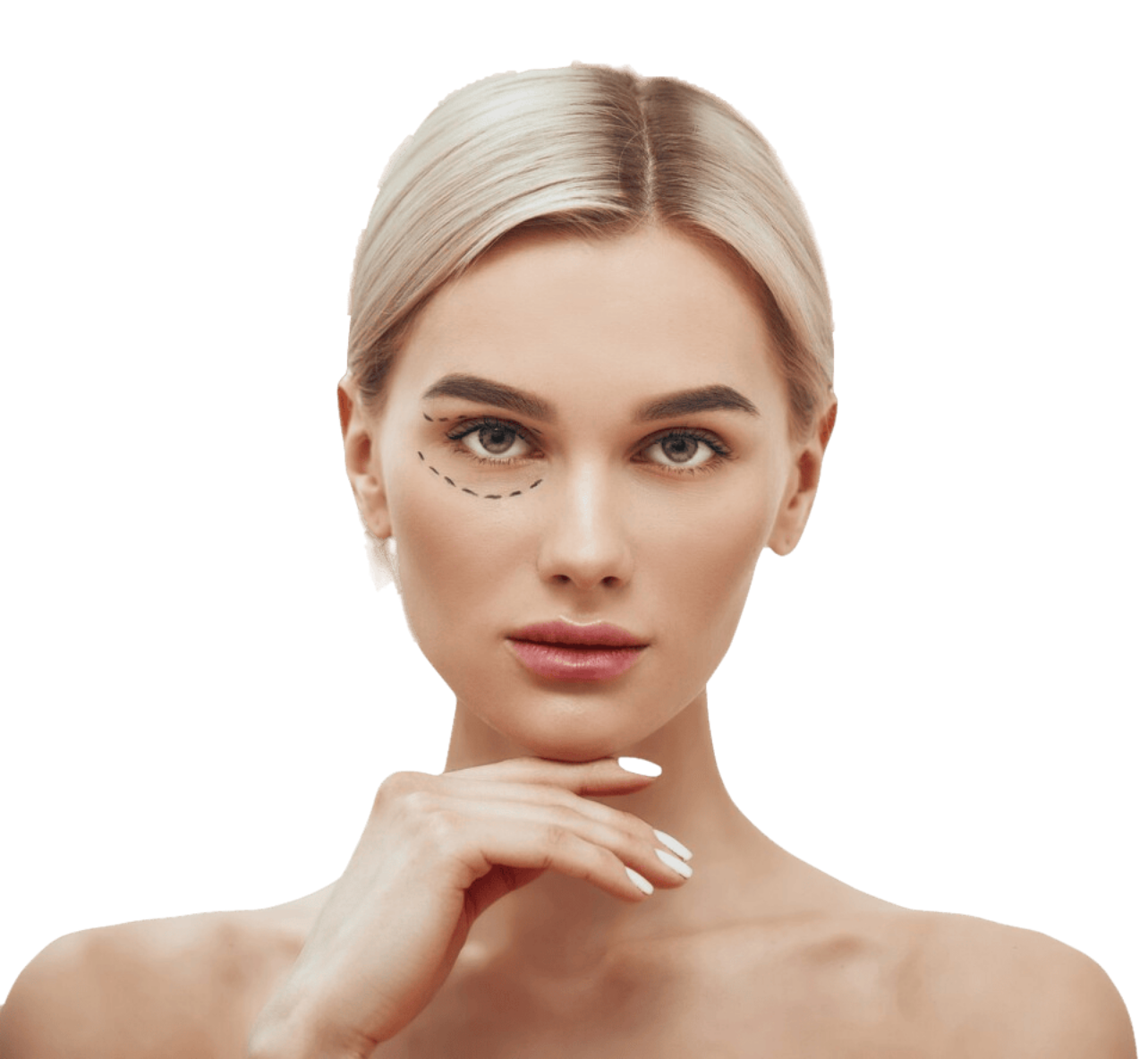 Верхняя блефаропластика — коррекция нависшего века