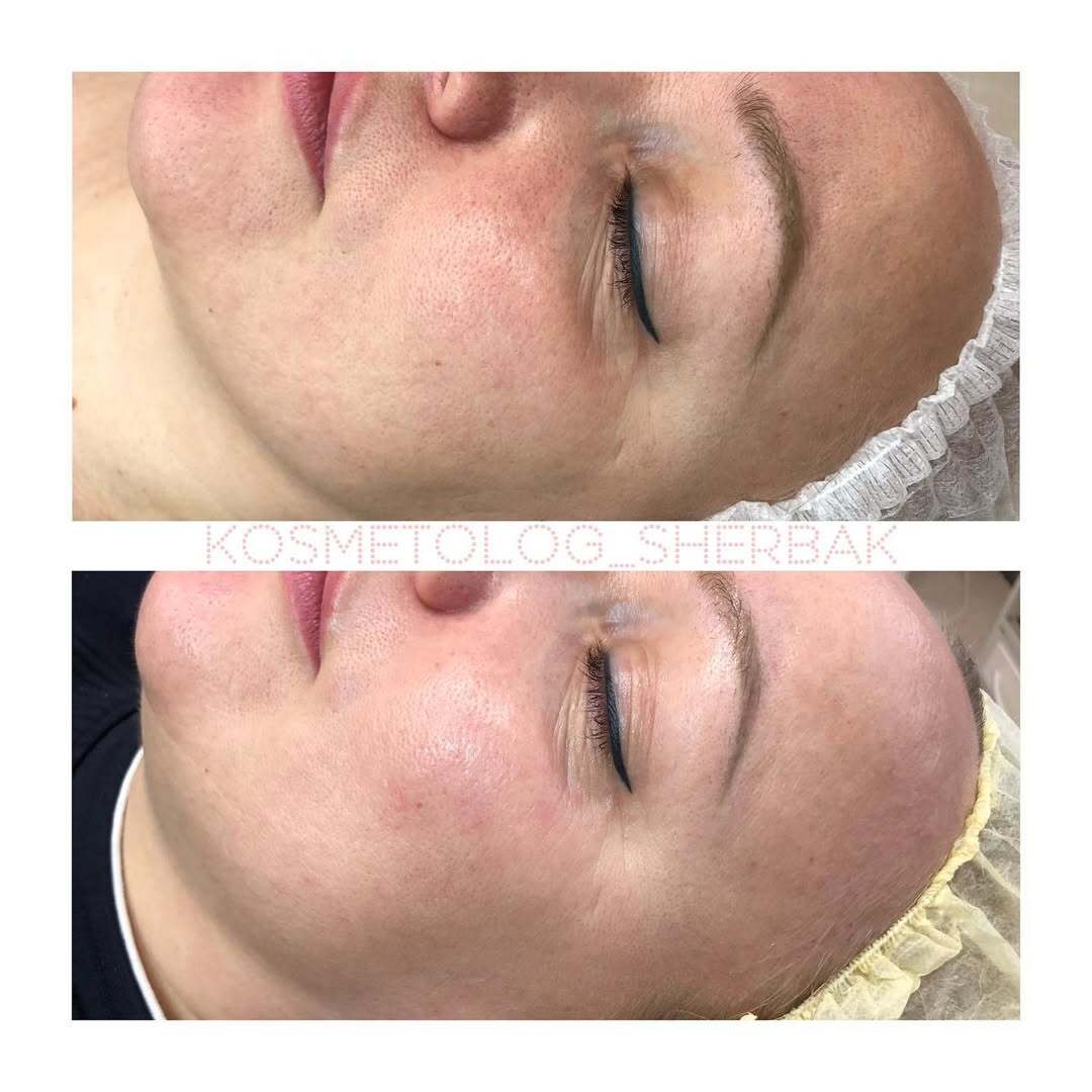 Индивидуальный подбор домашнего ухода в клинике PradusCOSMO, Санкт-Петербург. Косметологический анализ кожи и рекомендация профессиональной косметики