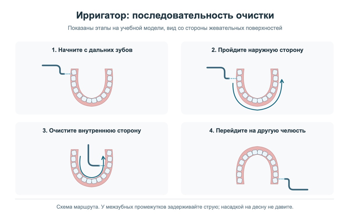 Последовательность очистки зубов ирригатором