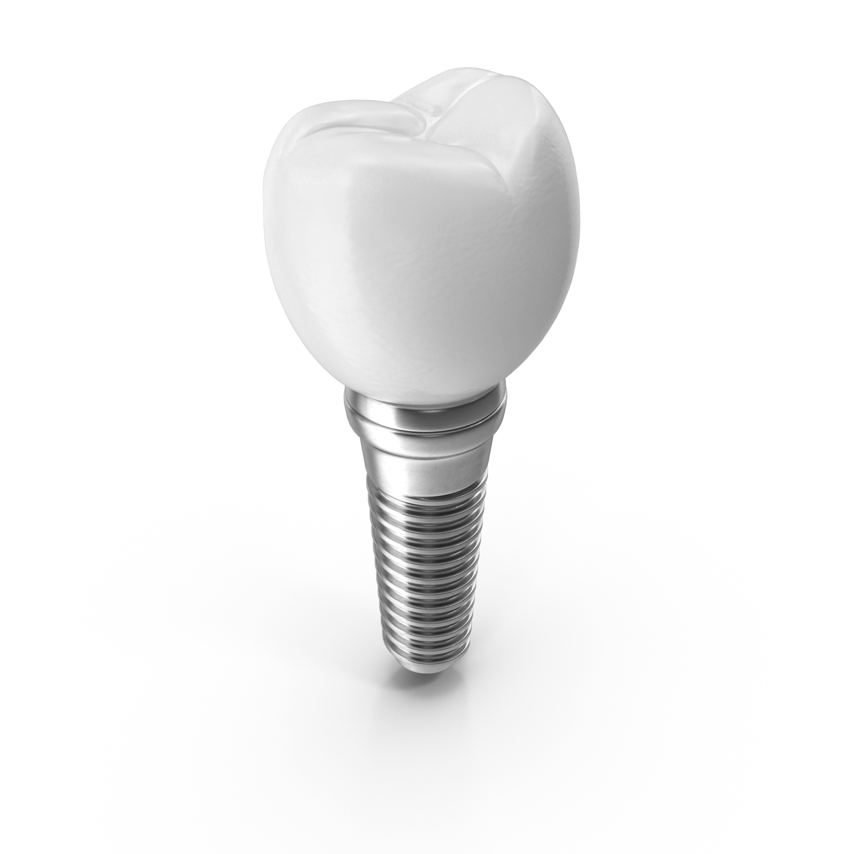 Виды имплантации зубов в стоматологии «Этна-Дент» - цена под ключ