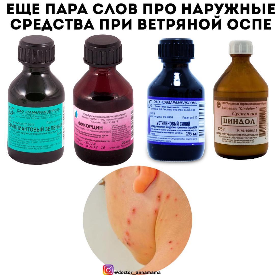 Можно Заниматься Сексом При Ветрянке Можно Заниматься Сексом При Ветрянке