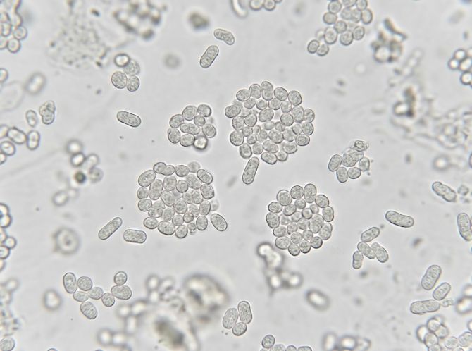 Ureaplasma species 