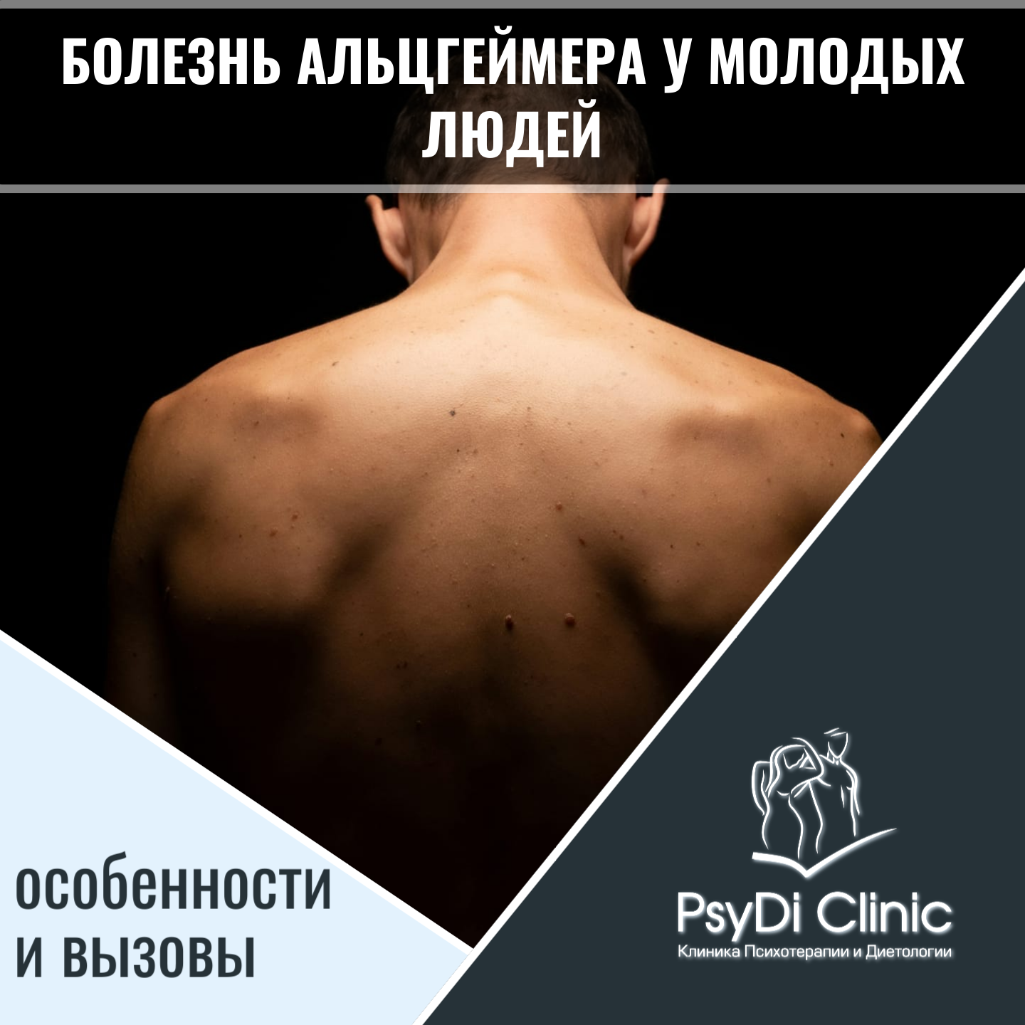 Болезнь Альцгеймера у молодых людей: особенности и вызовы