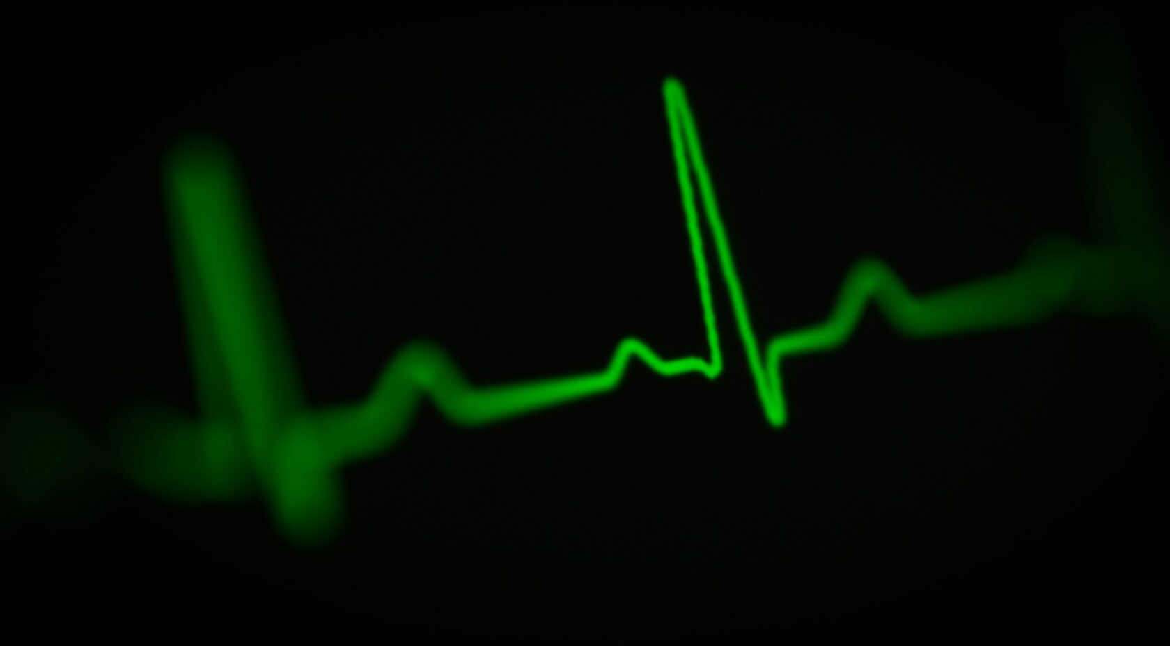 ECG heart monitor